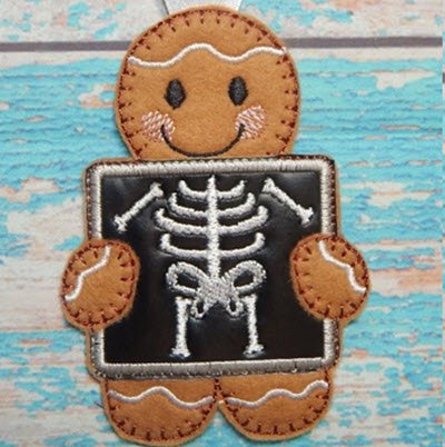 Ginger Xray